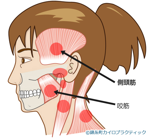 顎関節症の症状図